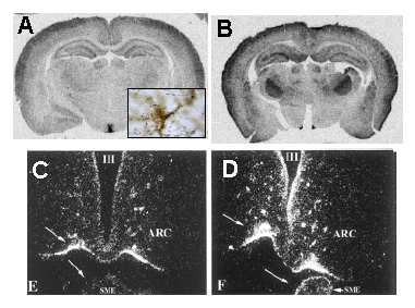 Fig 5.- Type 2 deiodinase mRNA expression in the rat brain. A: euthyroid rat. D2 mRNA is distributed all over the brain with high concentration in walls of the lower third of the 3rd ventricle. In this region, D2 is expressed in specialized glial cells called tanycytes. In the rest of the brain D2 is expressed in the astrocytes (the inset shows D2 mRNA hybridization silver grains over a stained astrocyte). B: D2 expression in a hypothyroid rat. An increased expression is observed in most parts of the brain, but especially in the barrel cortex and some structures such as the ventromedial nucleus, serving as relay stations for somatosensory pathways. C and D: Dark field photomicropgraphs of the 3rd ventricle, infundibular region and median eminence showing high expression of D2 mRNA in this area (C), and its increased expression in iodine deficient rats. Upper panels are data from the author. Lower panels are adapted from Peeters et al, Am J Physiol Endocrinol Metab 281: E54-E61, 2001.