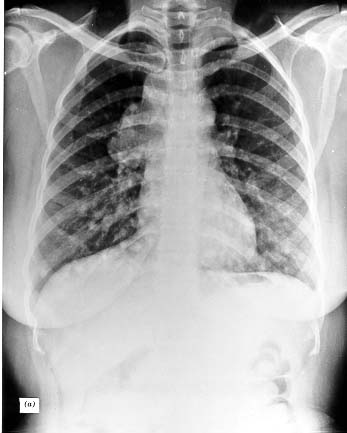 Figure 18-19a