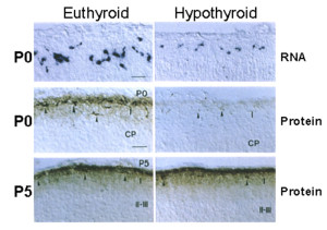 Fig 2.-Regulation of Reelin by thyroid hormone. The figure shows slices of the cerebral cortex from euthyroid and hypothyroid newborn rats. The upper panels show in situ hybridization for Reelin RNA. The midle and lower panels show immunohistochemistry of Reelin protein. The RNA is present in isolated cells of layer I, known as Cajal-Retzius cells. The RNA is very low in the hypothyroid animals. The Reelin protein is a matrix protein, seen in these slices concentrated also in layer I. On P0 there is no Reelin protein in the hypothyroid animals, but on P5, the amount of Reelin protein is normal (from (247)).