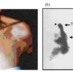 fig8