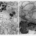 etx-lipidped-ch17-fig2