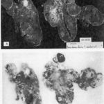 etx-lipidpeds-ch17-fig6