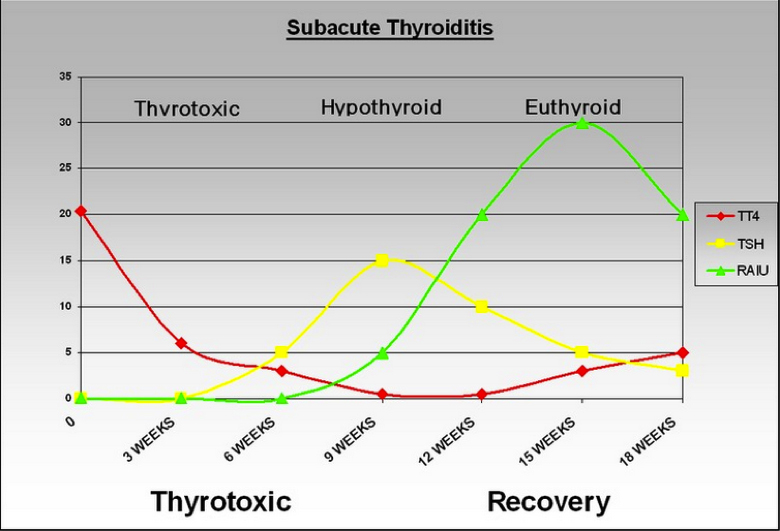 Figure 2. Thyroid function during the course of deQuervain’s (subacute) thyroiditis. During the thyrotoxic phase, Total T4 is high, and TSH is suppressed. Later during the period of hypothyroidism there is gradual increase in TSH until TSH is normalized. Radioactive Iodine uptake which is initially suppressed improves during recovery phase.